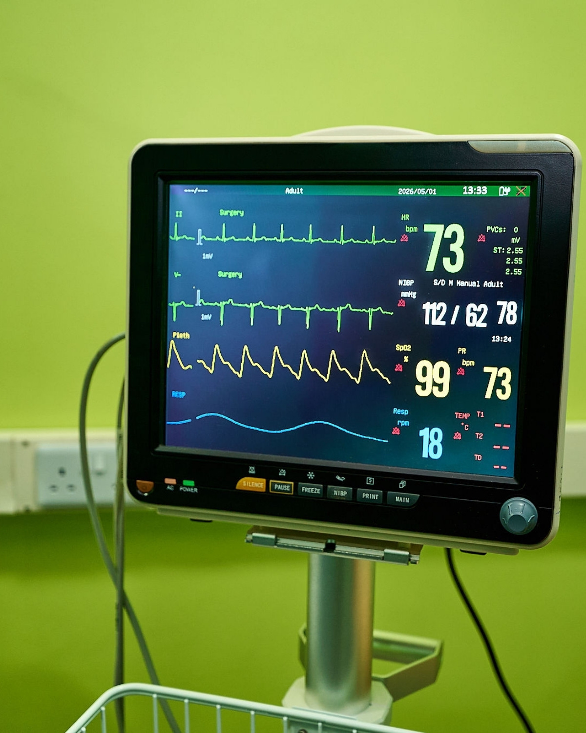 The critical-care vital-signs monitor at Parklands Mindcare Centre displaying ECG, blood pressure, oxygen saturation, and respiratory rate during a monitored ketamine session
